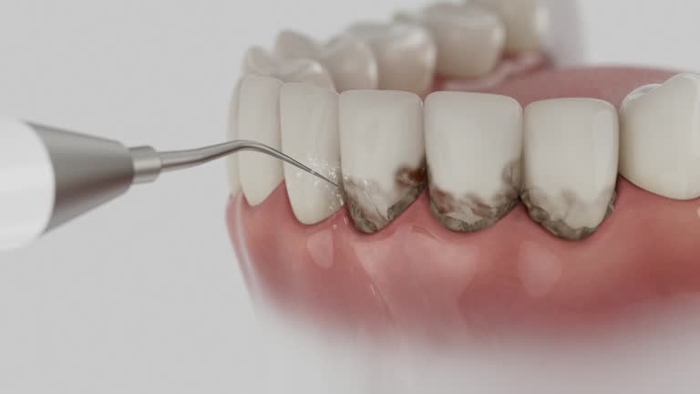 Reliable Dental contractor in Bellbrook, OH by Dentist Open Now